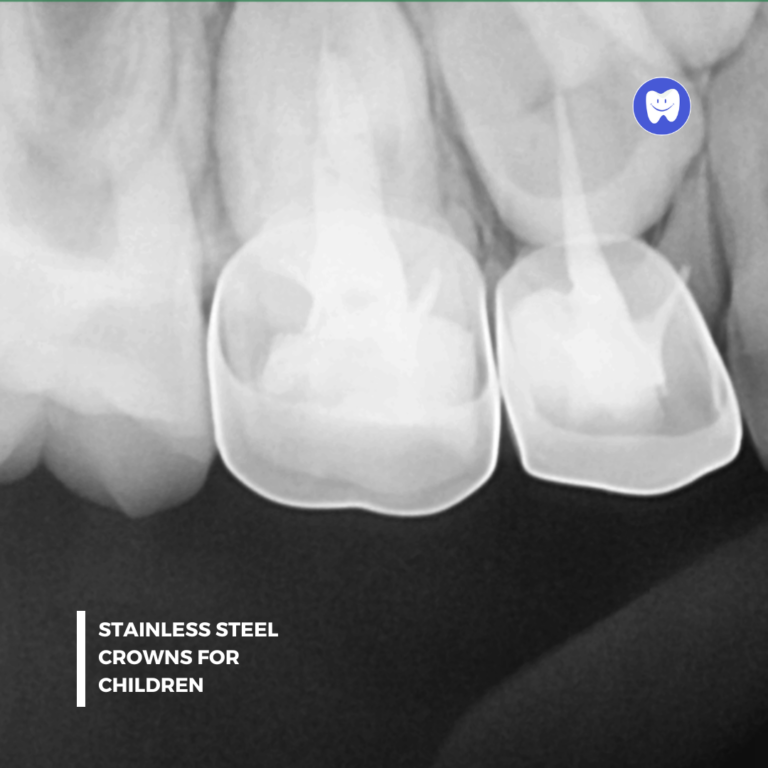 Aarna Vyas xray