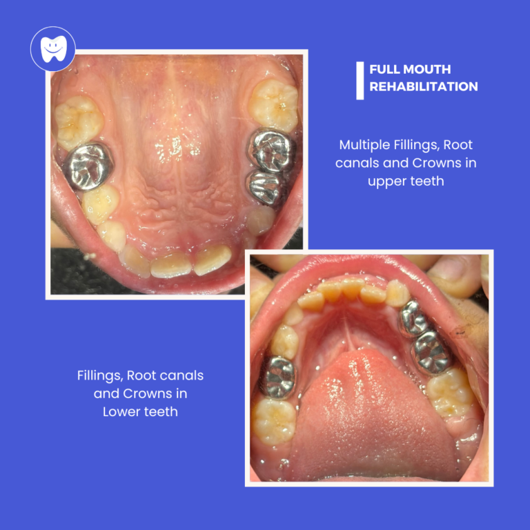 Bhavya FMR- Clinical